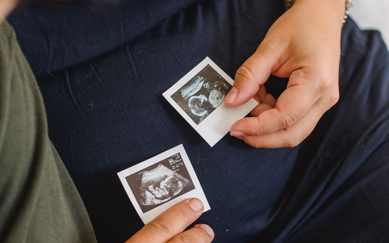 Embarazo múltiple por inseminación artificial