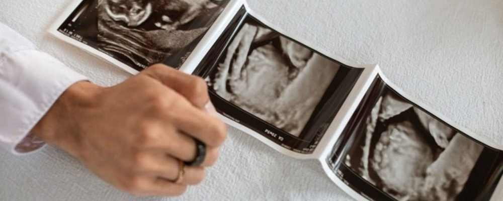 AMH Faible, Quelles Solutions Existent