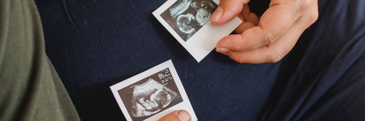 Varicocele e infertilidad masculina